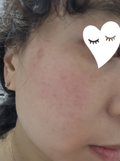 Before applying TIRTIR Red Cushion 21N